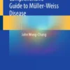 Comprehensive Guide to Müller-Weiss Disease