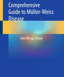 Comprehensive Guide to Müller-Weiss Disease