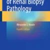 Handbook of Renal Biopsy Pathology