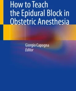 How to Teach the Epidural Block in Obstetric Anesthesia