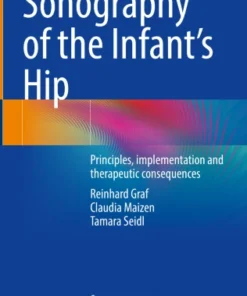 Sonography of the Infant’s Hip
Principles, implementation and therapeutic consequences