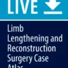 Limb Lengthening and Reconstruction Surgery Case Atlass