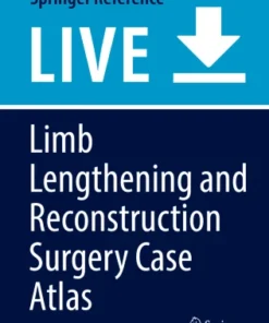 Limb Lengthening and Reconstruction Surgery Case Atlass