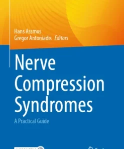 Nerve Compression Syndromes
A Practical Guide