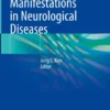 Neuropsychiatric Manifestations in Neurological Diseases