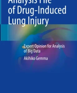 Analysis File of Drug-Induced Lung Injury
Expert Opinion for Analysis of Big Data