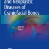 Inflammatory and Neoplastic Diseases of Craniofacial Bones