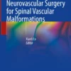 Endovascular and Neurovascular Surgery for Spinal Vascular Malformations