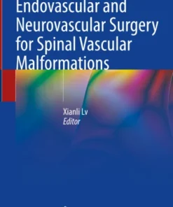 Endovascular and Neurovascular Surgery for Spinal Vascular Malformations