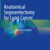 Anatomical Segmentectomy for Lung Cancer
Illustration and Videos