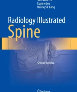 Radiology Illustrated: Spine