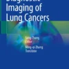 Diagnostic Imaging of Lung Cancers