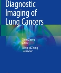 Diagnostic Imaging of Lung Cancers