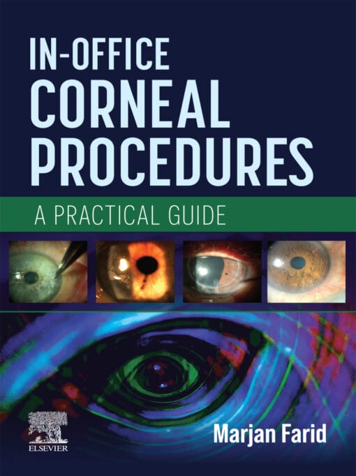 In-Office Corneal Procedures: A Practical Guide (PDF)