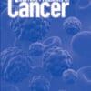 Current Problems in Cancer PDF