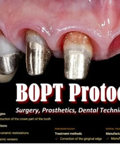 OHI-S BOPT Protocols Surgery, Prosthetics, Dental Technician Stage