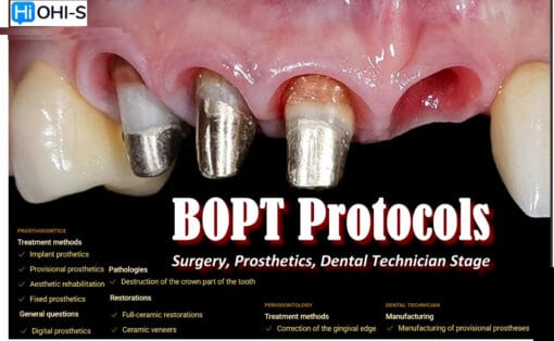 OHI-S BOPT Protocols Surgery, Prosthetics, Dental Technician Stage