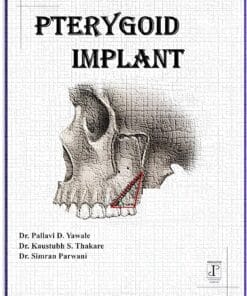 PTERYGOID IMPLANT PDF