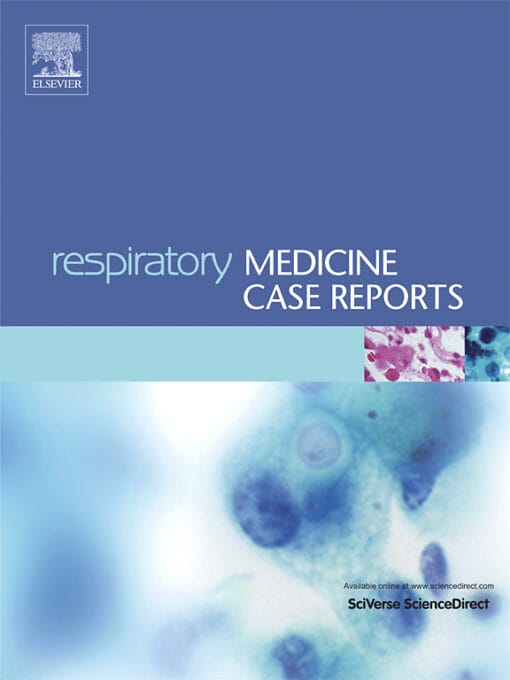 Respiratory Medicine Case Reports PDF