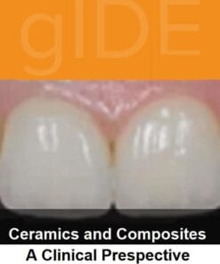 gIDE online lectures – Ceramic and Composits, A Clinical Perspective   