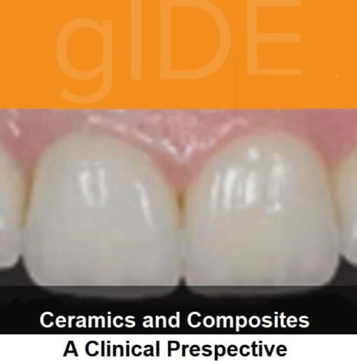 gIDE online lectures – Ceramic and Composits, A Clinical Perspective   