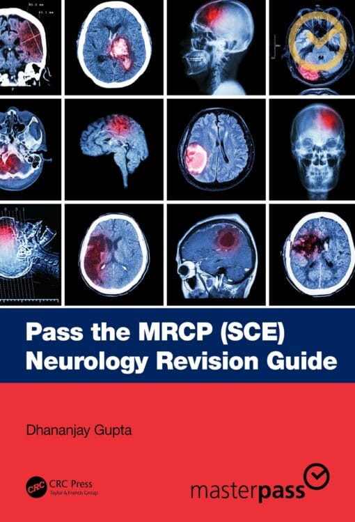 Pass the MRCP (SCE) Neurology Revision Guide (MasterPass) (PDF)