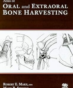 Atlas Of Oral And Extraoral Bone Harvesting (Scanned PDF)