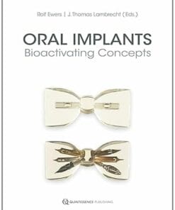 Oral Implants: Bioactivating Concepts (Scanned PDF)