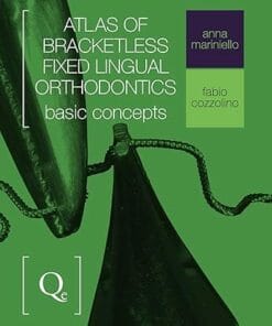 Atlas Of Bracketless Fixed Lingual Orthodontics: Basic Concepts (Scanned PDF)