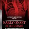 Early Onset Scoliosis: A Comprehensive Approach (PDF)