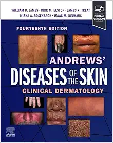 Andrews’ Diseases Of The Skin: Clinical Dermatology, 14th Edition (PDF)