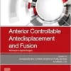 Anterior Controllable Antedisplacement And Fusion: Technique In Spinal Surgery (PDF)