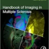 Handbook Of Imaging In Multiple Sclerosis (PDF)