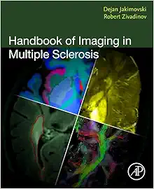 Handbook Of Imaging In Multiple Sclerosis (PDF)