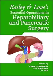 Bailey & Love’s Essential Operations In Hepatobiliary And Pancreatic Surgery (PDF)