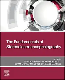 The Fundamentals of Stereoelectroencephalography (PDF)