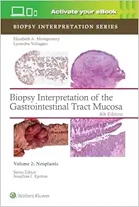 Biopsy Interpretation Of The Gastrointestinal Tract Mucosa: Neoplastic, Volume 2, 4th Edition (EPUB)