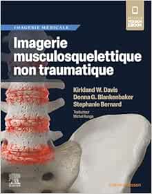 Imagerie Musculosquelettique Non Traumatique (PDF)