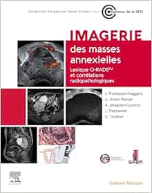 Imagerie Des Masses Annexielles: Lexique O-RADS Et Corrélations Radiopathologiques (PDF)