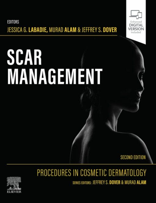 Procedures In Cosmetic Dermatology: Scar Management, 2nd Edition (PDF)