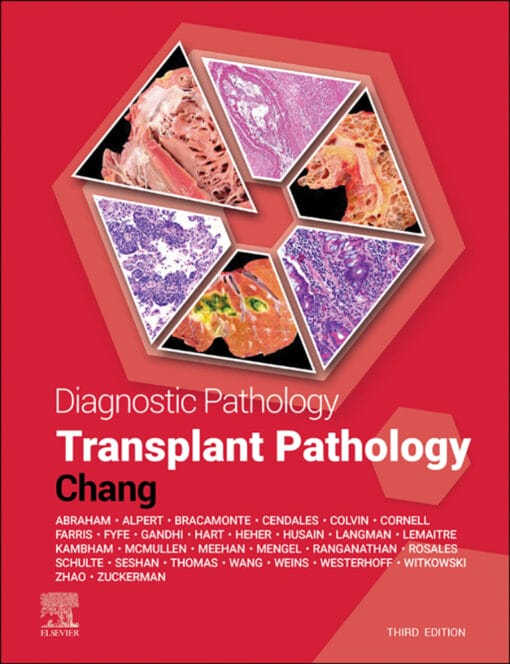 Diagnostic Pathology: Transplant Pathology, 3rd Edition (EPUB)