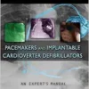 Pacemakers And Implantable Cardioverter Defibrillators: An Expert’s Manual (PDF)