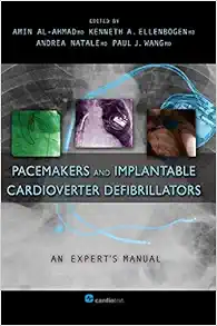 Pacemakers And Implantable Cardioverter Defibrillators: An Expert’s Manual (PDF)