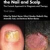 Fungal Infections Of The Nail And Scalp: The Current Approach To Diagnosis And Therapy, 3rd Edition (PDF)