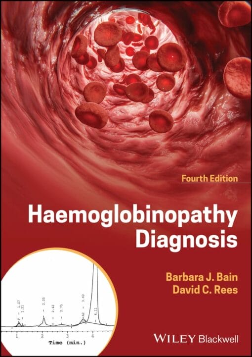 Haemoglobinopathy Diagnosis, 4th Edition (EPUB)