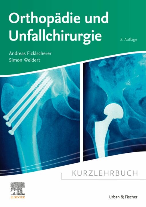 Kurzlehrbuch Orthopädie Und Unfallchirurgie, 2nd Edition (PDF)