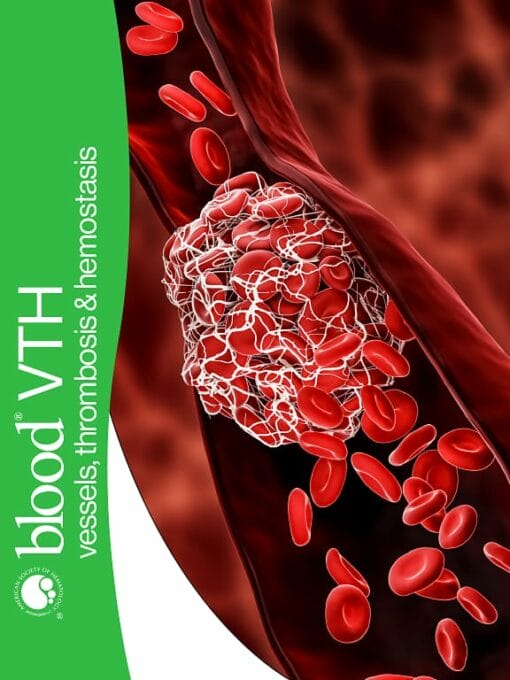 Blood Vessels, Thrombosis & Hemostasis PDF