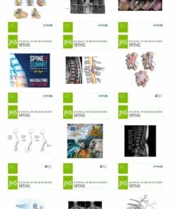 Journal of Neurosurgery Spine 2024 Full Archives (True PDF)