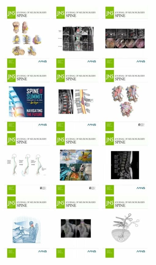 Journal of Neurosurgery Spine 2024 Full Archives (True PDF)