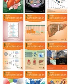 Liver Transplantation 2024 Full Archives (True PDF)